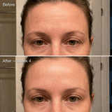 LaLume Recovery Signal Serum