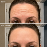 LaLume Recovery Signal Serum