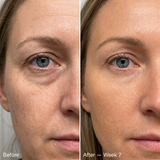 LaLume Recovery Signal Serum