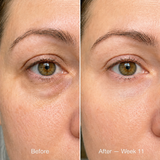 LaLume Recovery Signal Serum